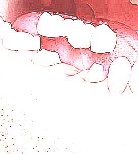 Зубная цементная смесь (фото)